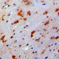 Anti-PDRG1 Antibody