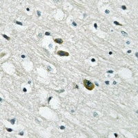 Anti-ANT4 Antibody