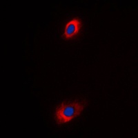 Anti-ANT4 Antibody