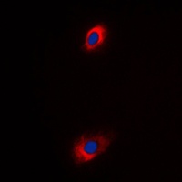 SLC25A31 antibody