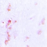 Anti-CDCA3 Antibody