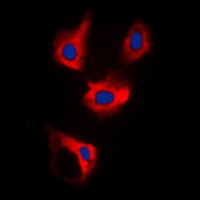 Anti-CDCA3 Antibody