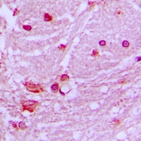 Anti-DNAL1 Antibody