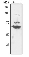 Histone Deacetylase 10 Rabbit Polyclonal Antibody