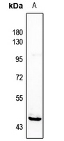 HORMAD1 Rabbit Polyclonal Antibody