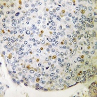 Anti-CIP29 Antibody