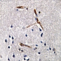 ACRBP antibody