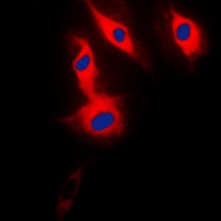 ACRBP antibody