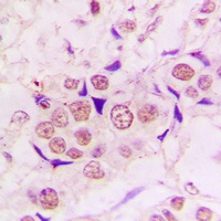 Anti-ZC3H8 Antibody