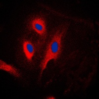 Anti-CARD6 Antibody