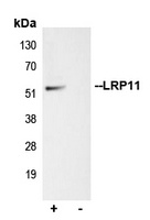 Anti-LRP11 Antibody