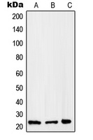 RAB2B Antibody
