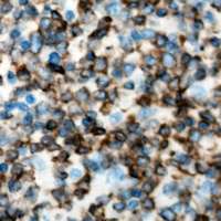 Anti-RELT Antibody