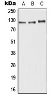 ABCC11 Antibody