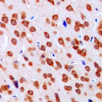 Anti-DCLK3 Antibody