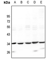 ODC Rabbit Polyclonal Antibody