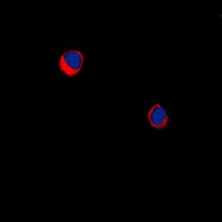 Anti-ARRDC1 Antibody