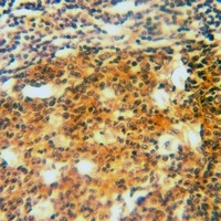 Anti-ARMC6 Antibody