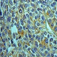 Anti-ABCC12 Antibody