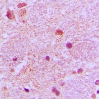 Anti-TP53INP1 Antibody