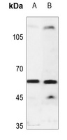 Cytochrome P450 2U1 Rabbit Polyclonal Antibody