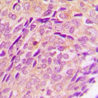 Anti-Cytochrome P450 2U1 Antibody