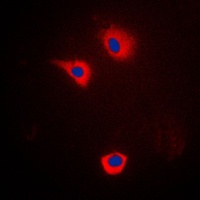 Anti-Cytochrome P450 2U1 Antibody