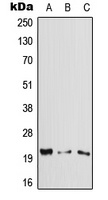 Cytoglobin Rabbit Polyclonal Antibody