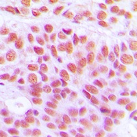 Anti-Histone H4 (Acetyl-K12) Antibody