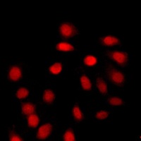 Anti-Histone H4 (Acetyl-K12) Antibody