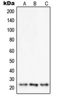 SENP8 Rabbit Polyclonal Antibody