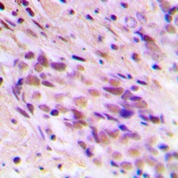 Anti-CDYL2 Antibody