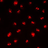 Anti-CDYL2 Antibody