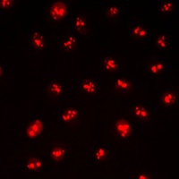 CDYL2 antibody