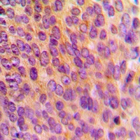 Anti-MRPL10 Antibody