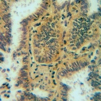 Anti-APOA1BP Antibody