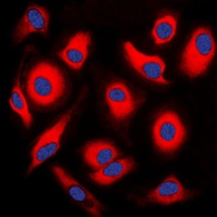 Anti-APOA1BP Antibody