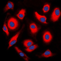 Apolipoprotein AI antibody