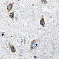 Anti-Neuromedin S Antibody
