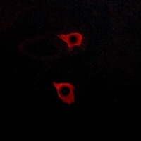 Anti-GPR175 Antibody
