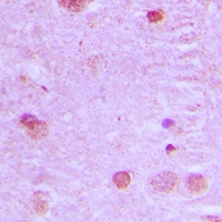 NCOA7 antibody