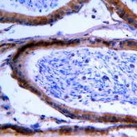 Anti-GCNT7 Antibody