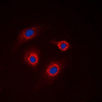 Anti-GCNT7 Antibody