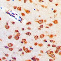 Anti-Cerebellin 4 Antibody