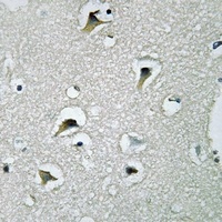 Anti-RPL10L Antibody