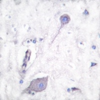 Anti-CD172a Antibody