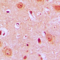Anti-PTGR2 Antibody