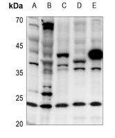 Cerebellin 2 Antibody