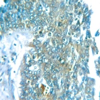 Anti-Cerebellin 2 Antibody