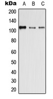 Desmoglein 4 Rabbit Polyclonal Antibody